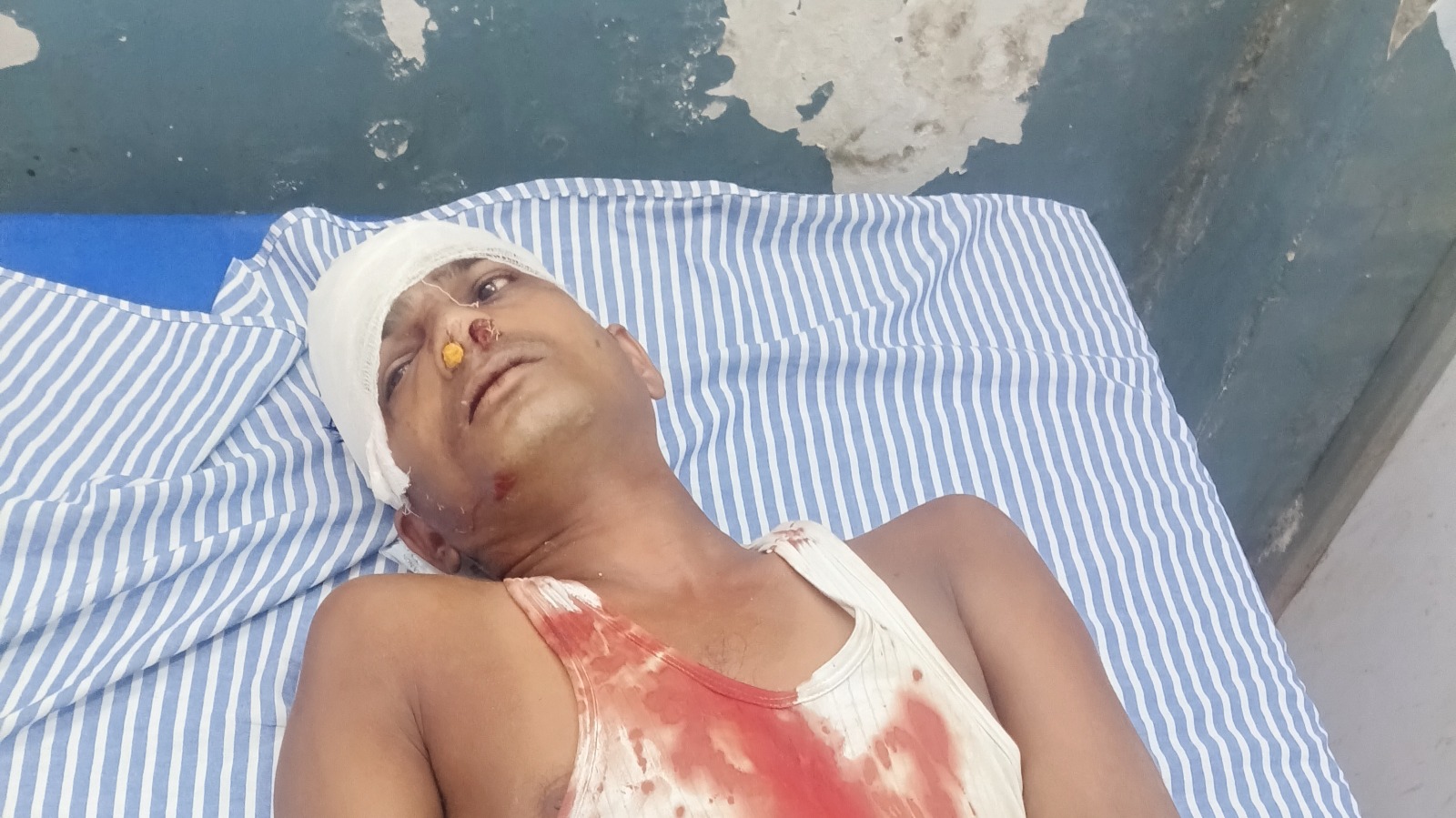 हाईटेंशन लाइन की चपेट में आकर नीचे नाले पर गिरा युवक