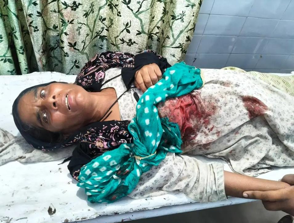 घर के बाहर खड़ी महिला पर झपटा सांड, उठाकर पटका
