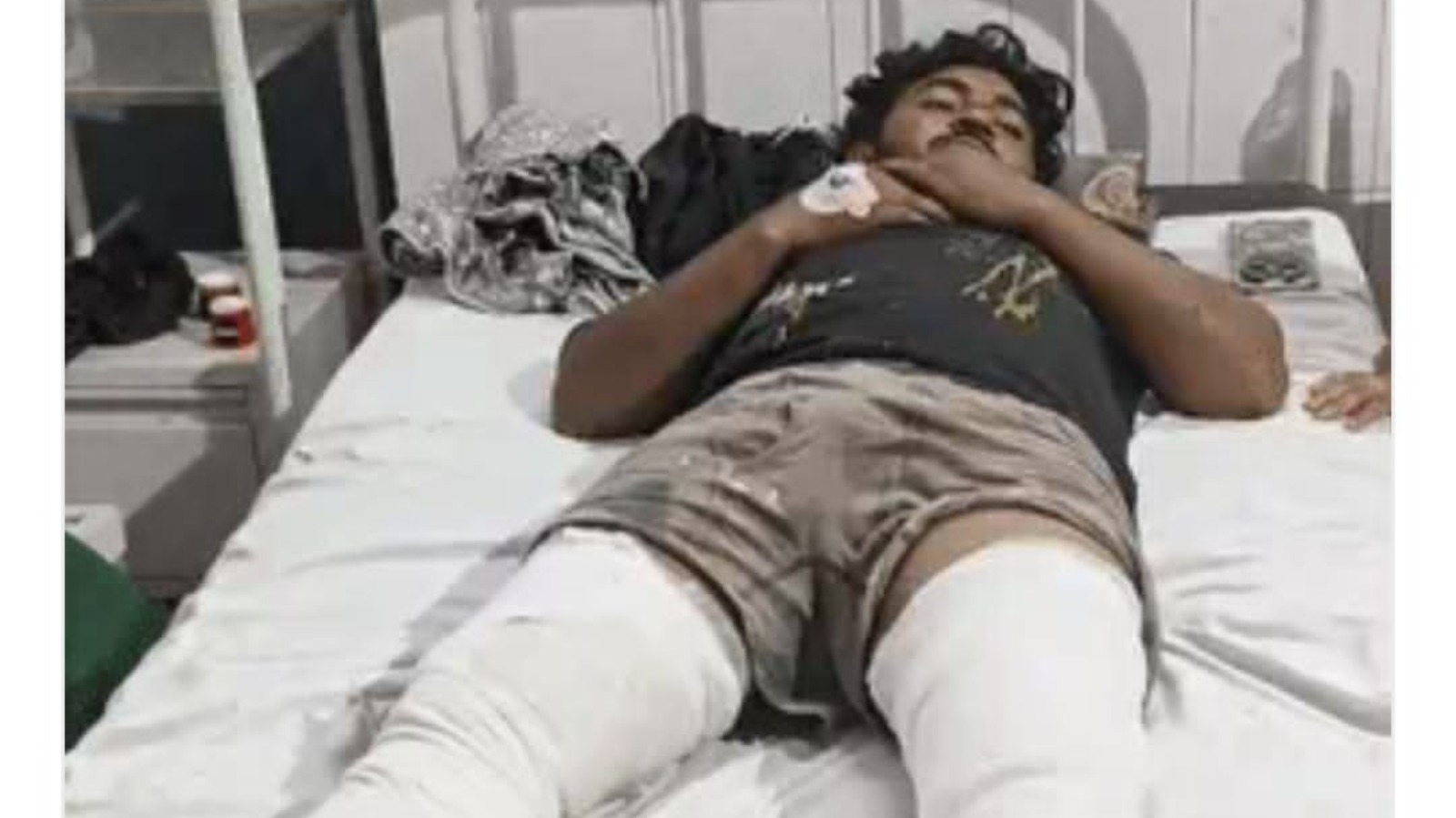 शादी से इंकार करने पर प्रेमिका ने प्रेमी की कराई पिटाई , हाथ-पैर तोड़े