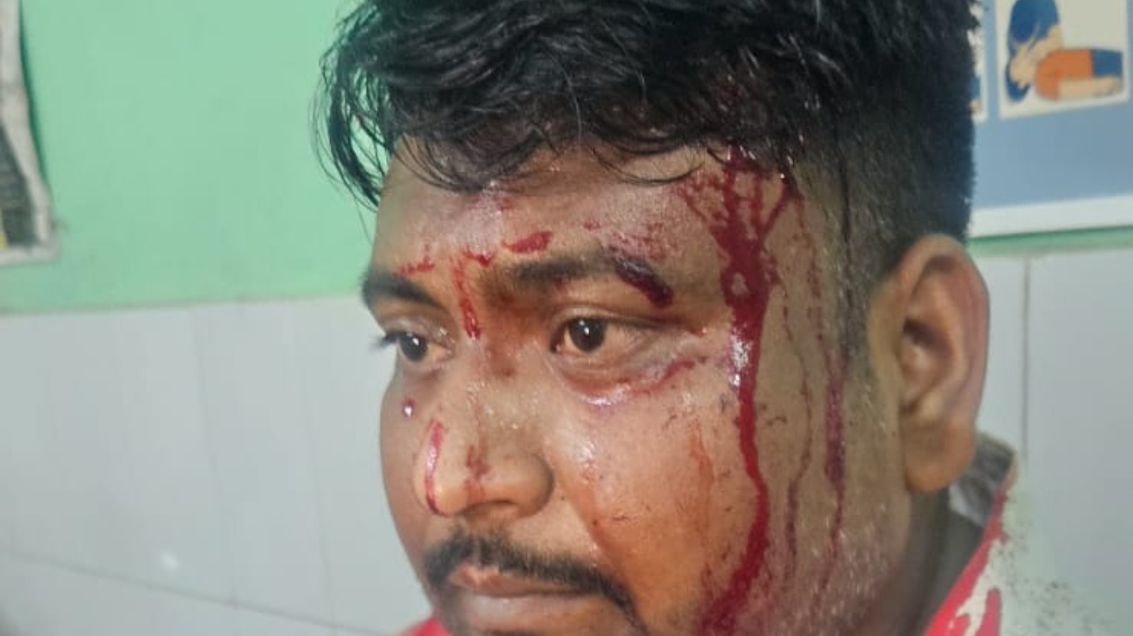 जमीन विवाद को लेकर प्रॉपर्टी डीलर पर जानलेवा हमला