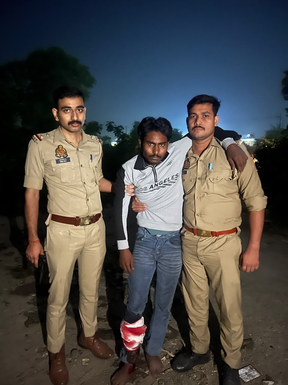 पुलिस अभिरक्षा से फरार 25 हजार का इनामी बदमाश मुठभेड़ में गिरफ्तार, पैर में लगी गोली