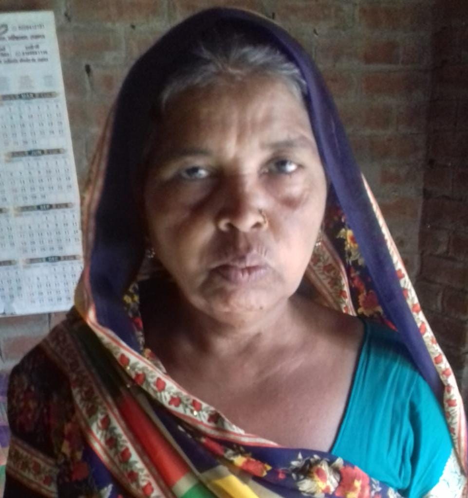 साबुन उठाने गई महिला को सांप ने डसा, मौत