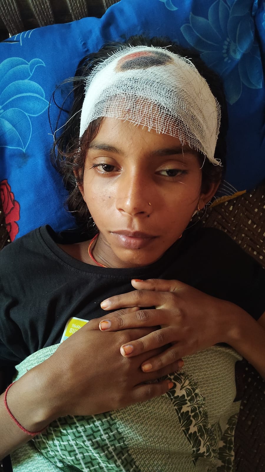 बंदरों के आतंक से दहशत में ग्रामीण, छत टूटने से छात्रा घायल