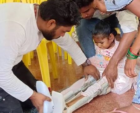 75 जिलों में लगेंगे सहायक उपकरण-कृत्रिम अंग वितरण शिविर